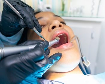 How Soon Should You Eat After A Tooth Extraction